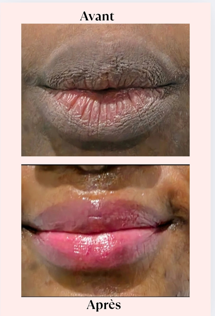 BAUME A LEVRES VEGETAL-HYDRATATION INTENSE DES LEVRES ASSUREE